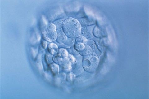 http://nantong.quanwangkm.com/post/190.html|南通人工试管
